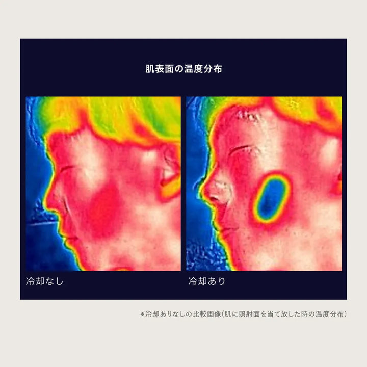 Re・De デュオクリアIPL 光美容器｜Re・De