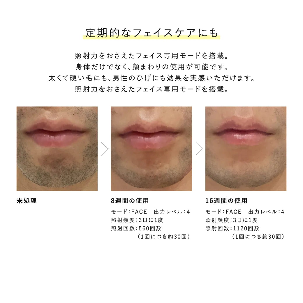 Re・De デュオクリアIPL 光美容器｜Re・De