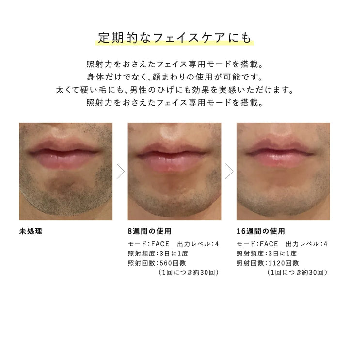 Re・De デュオクリアIPL 光美容器｜Re・De