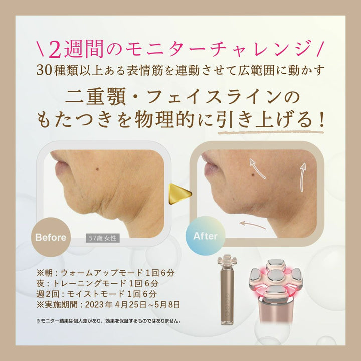 ゾーガンキン ブルーム｜ZOGANKIN